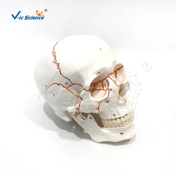 Цифровая модель анатомии черепа с отметкой о месте наложения шва